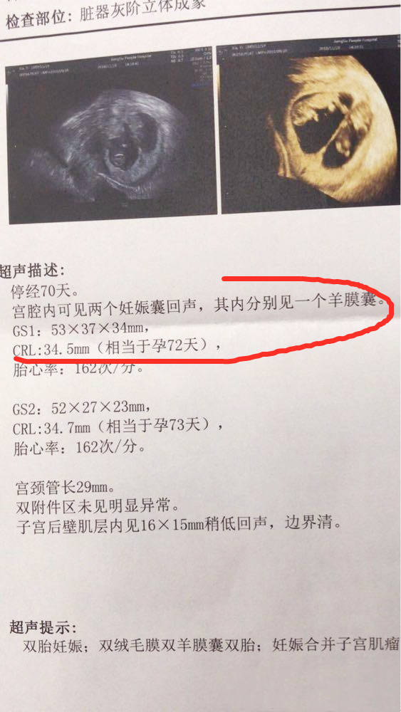 36歲女子懷孕34周的高血壓診斷