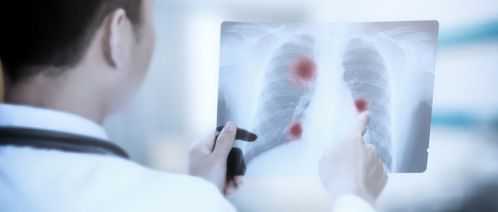 甲狀腺健康習(xí)慣與良好狀態(tài)