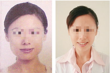 小游戲攻略怎么瘦臉