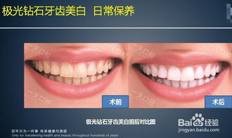 口腔什么項(xiàng)目最賺錢女