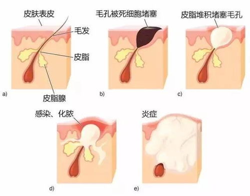 口腔什么項(xiàng)目最賺錢女