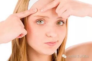 痘痘是什么星座的,你知道痘痘是誰嗎