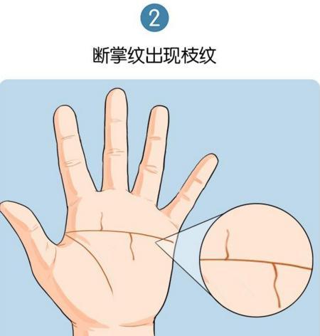 斷掌紋的人運勢如何（斷掌紋的人會怎么樣）