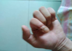 左手食指受傷運勢如何（左手食指受傷暗示什么）