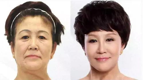 如何改善面相運(yùn)勢(shì)（怎么可以改變面相）