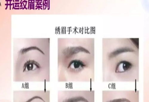 眉毛上起痘運(yùn)勢如何（眉毛上出痘）