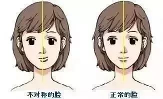 齙牙如何改變運勢（齙牙怎么改正）