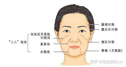 淚溝紋面相運(yùn)勢(shì)如何（淚溝紋很嚴(yán)重怎么辦）