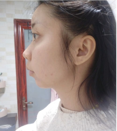 側(cè)臉大的人運勢如何（側(cè)臉大怎么改善）