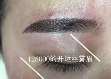 眉毛上起痘運(yùn)勢如何查（眉毛上長痘對應(yīng)五臟的圖）