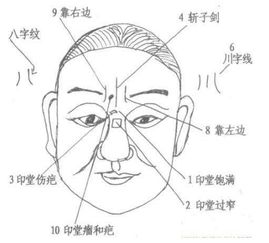 印堂紋如何看運(yùn)勢(shì)（印堂紋第四十五種圖解）