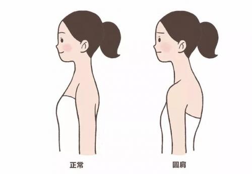 如何改善駝背的女人運(yùn)勢(shì)（如何改善駝背的女人運(yùn)勢(shì)問題）